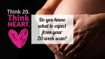 Do you know what to expect from your 20-week scan?